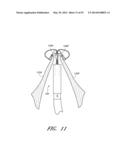 SUTURING DEVICES AND METHODS FOR SUTURING AN ANATOMIC VALVE diagram and image