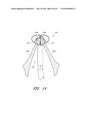 SUTURING DEVICES AND METHODS FOR SUTURING AN ANATOMIC VALVE diagram and image