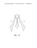 SUTURING DEVICES AND METHODS FOR SUTURING AN ANATOMIC VALVE diagram and image