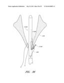 SUTURING DEVICES AND METHODS FOR SUTURING AN ANATOMIC VALVE diagram and image