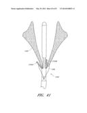 SUTURING DEVICES AND METHODS FOR SUTURING AN ANATOMIC VALVE diagram and image