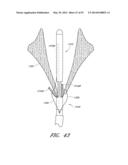 SUTURING DEVICES AND METHODS FOR SUTURING AN ANATOMIC VALVE diagram and image