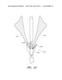 SUTURING DEVICES AND METHODS FOR SUTURING AN ANATOMIC VALVE diagram and image