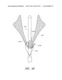 SUTURING DEVICES AND METHODS FOR SUTURING AN ANATOMIC VALVE diagram and image