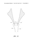 SUTURING DEVICES AND METHODS FOR SUTURING AN ANATOMIC VALVE diagram and image