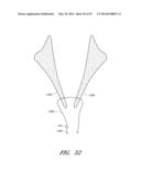 SUTURING DEVICES AND METHODS FOR SUTURING AN ANATOMIC VALVE diagram and image