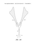 SUTURING DEVICES AND METHODS FOR SUTURING AN ANATOMIC VALVE diagram and image