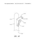 SUTURING DEVICES AND METHODS FOR SUTURING AN ANATOMIC VALVE diagram and image