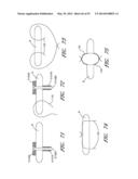 SUTURING DEVICES AND METHODS FOR SUTURING AN ANATOMIC VALVE diagram and image