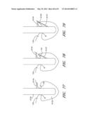 SUTURING DEVICES AND METHODS FOR SUTURING AN ANATOMIC VALVE diagram and image