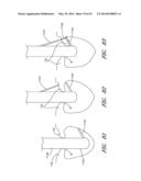 SUTURING DEVICES AND METHODS FOR SUTURING AN ANATOMIC VALVE diagram and image