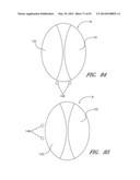 SUTURING DEVICES AND METHODS FOR SUTURING AN ANATOMIC VALVE diagram and image