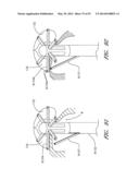 SUTURING DEVICES AND METHODS FOR SUTURING AN ANATOMIC VALVE diagram and image