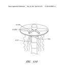 SUTURING DEVICES AND METHODS FOR SUTURING AN ANATOMIC VALVE diagram and image