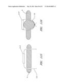 SUTURING DEVICES AND METHODS FOR SUTURING AN ANATOMIC VALVE diagram and image