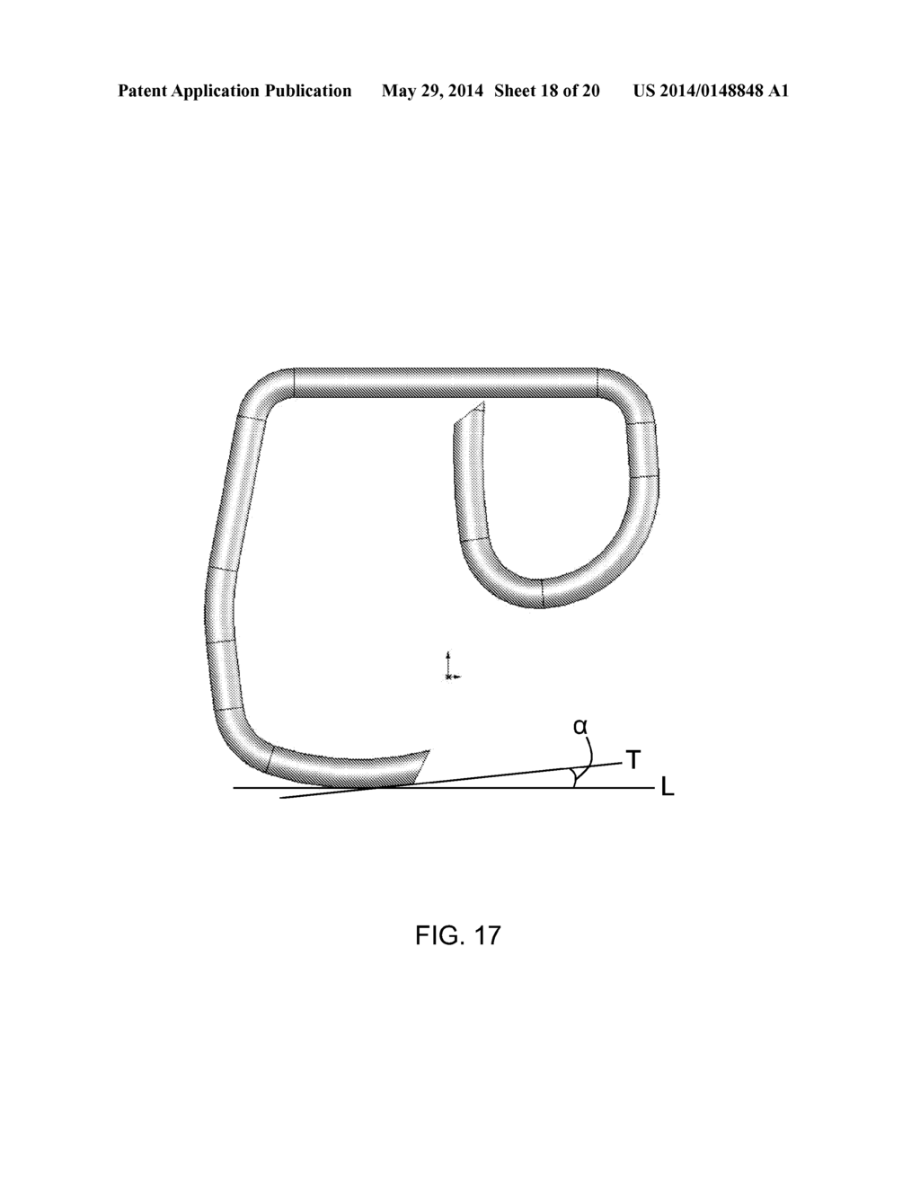 Adjustable Compression Staple and Method for Stapling With Adjustable     Compression - diagram, schematic, and image 19