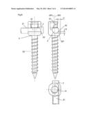 SPINAL OSTEOSYNTHESIS DEVICE AND PREPARATION METHOD diagram and image