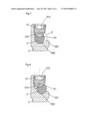 SPINAL OSTEOSYNTHESIS DEVICE AND PREPARATION METHOD diagram and image