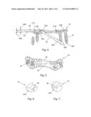 ORTHOPEDIC FUSION PLATE AND COMPRESSION SCREW diagram and image