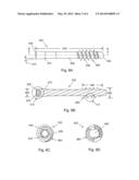 ORTHOPEDIC FUSION PLATE AND COMPRESSION SCREW diagram and image