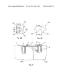 ORTHOPEDIC FUSION PLATE AND COMPRESSION SCREW diagram and image