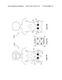 TRANSCUTANEOUS STIMULATION METHOD AND SYSTEM diagram and image