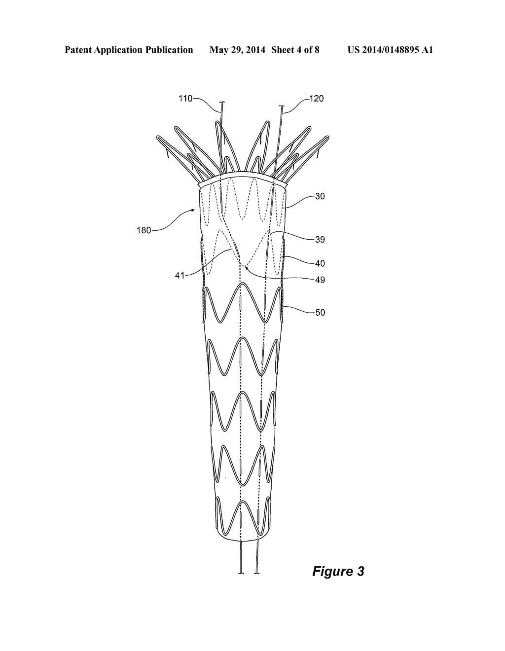 ASSEMBLY OF STENT GRAFTS WITH DIAMETER REDUCING TIES - diagram, schematic, and image 05