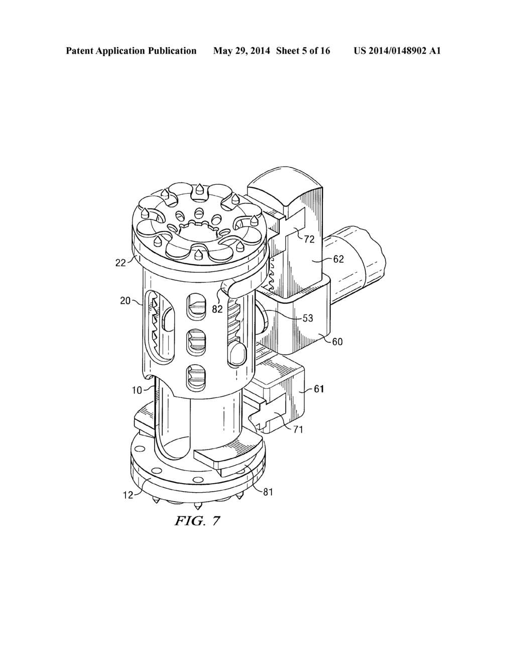 EXPANDABLE IMPLANT, INSTRUMENT, AND METHOD - diagram, schematic, and image 06