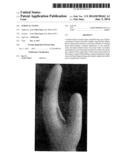 SURGICAL GLOVE diagram and image