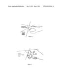 SURGICAL GLOVE diagram and image