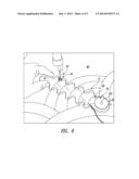 METHOD AND DEVICE FOR SEWING DESIGNS diagram and image