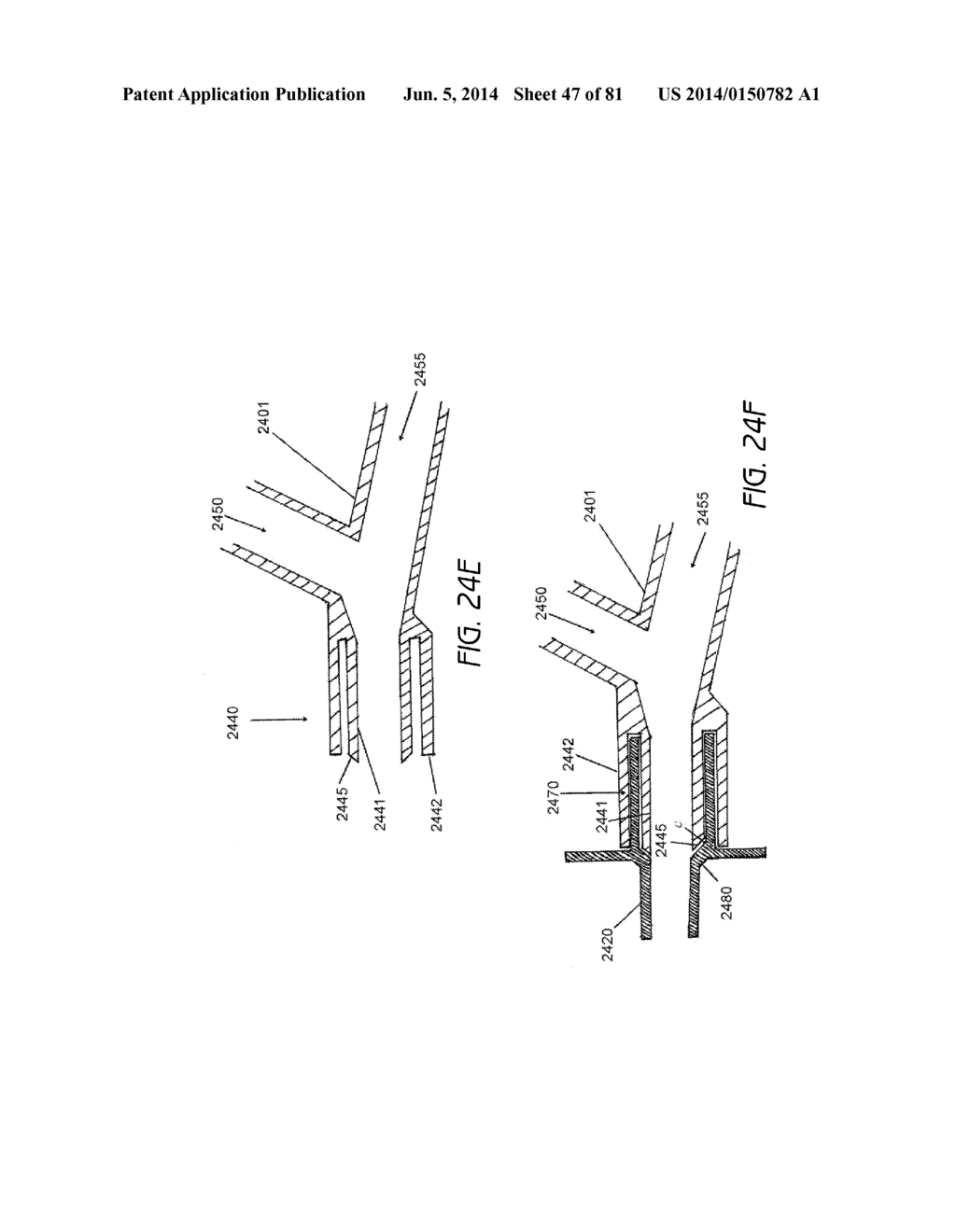 CLOSED SUCTION CLEANING DEVICES, SYSTEMS AND METHODS - diagram, schematic, and image 48