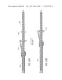 CLOSED SUCTION CLEANING DEVICES, SYSTEMS AND METHODS diagram and image