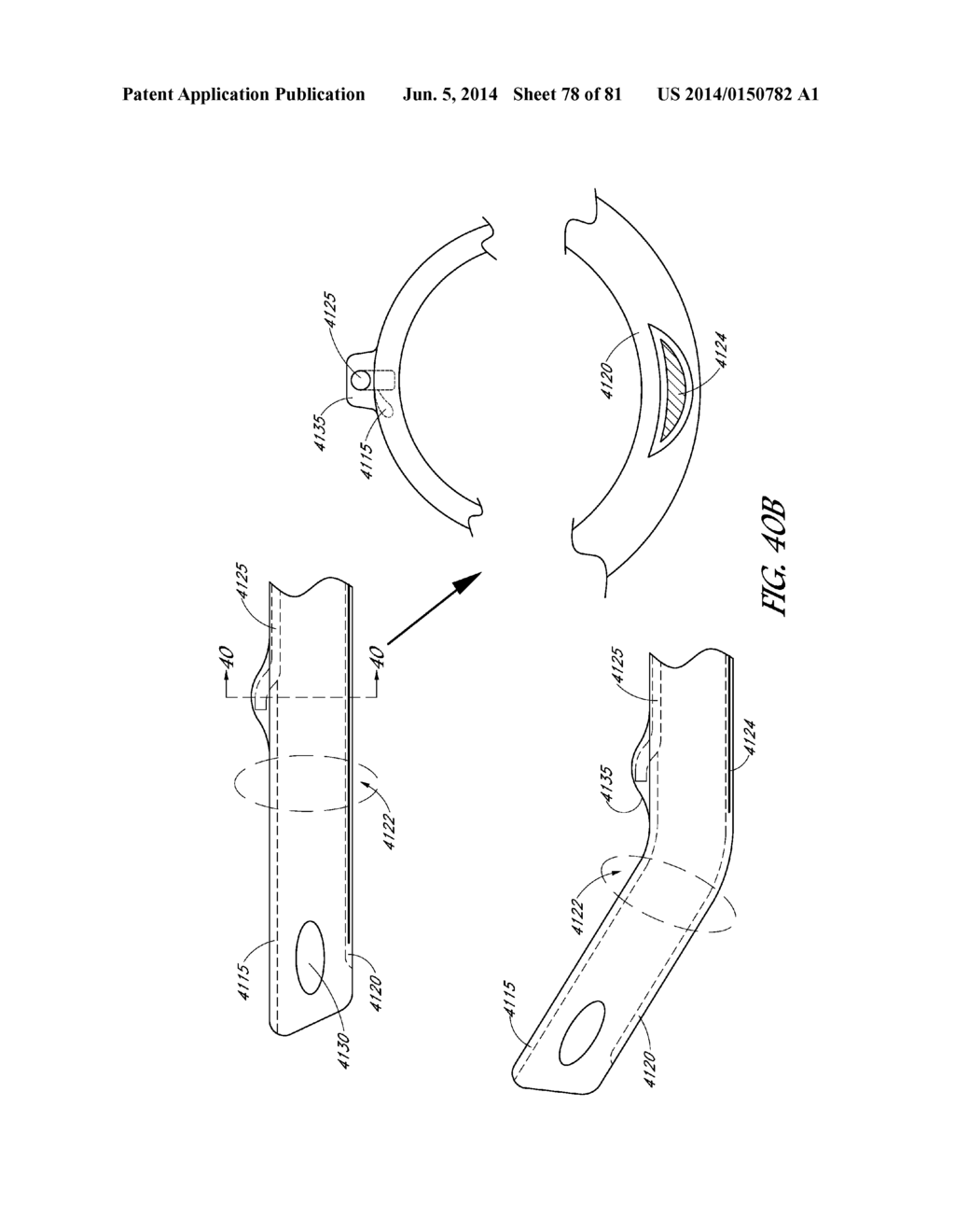 CLOSED SUCTION CLEANING DEVICES, SYSTEMS AND METHODS - diagram, schematic, and image 79