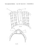 Modular Tire with Variable Tread Surfaces diagram and image