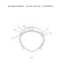 Modular Tire with Variable Tread Surfaces diagram and image