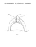 Modular Tire with Variable Tread Surfaces diagram and image