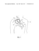 INSULATOR FOR A FEEDTHROUGH diagram and image