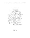 Surgical Device with Tandem Fasteners diagram and image