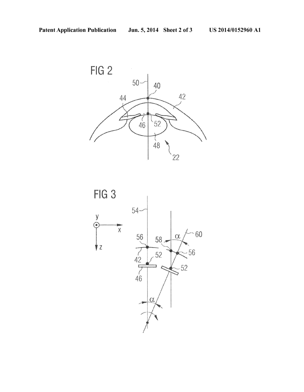 INSTRUMENT FOR EXAMINING OR MACHINING A HUMAN EYE - diagram, schematic, and image 03