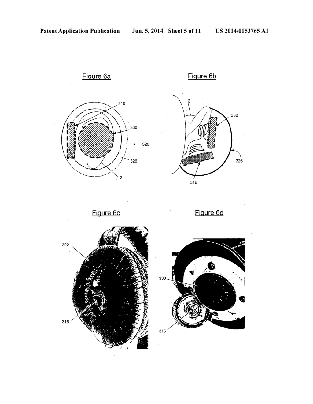 Listening Device and Accompanying Signal Processing Method - diagram, schematic, and image 06