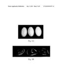 Packaged Antiperspirant Compositions diagram and image