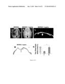 Methods and Compositions for Improved Tissue Regeneration by Suppression     of Interferon-Gamma and Tumor Necrosis Factor-Alpha diagram and image