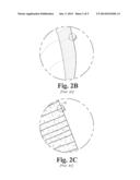 DENTAL COMPOSITIONS CONTAINING SILICA MICROBEADS diagram and image