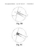 DENTAL COMPOSITIONS CONTAINING SILICA MICROBEADS diagram and image