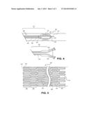 METHODS AND COMPOSITIONS FOR TREATMENT OF LESIONED SITES OF BODY VESSELS diagram and image