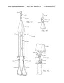 FULL BODY EXERCISE BAND SYSTEM diagram and image