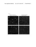 SYSTEM FOR IDENTIFICATION OF MICROORGANISM AND DETECTION OF INFECTIOUS     DISEASE diagram and image