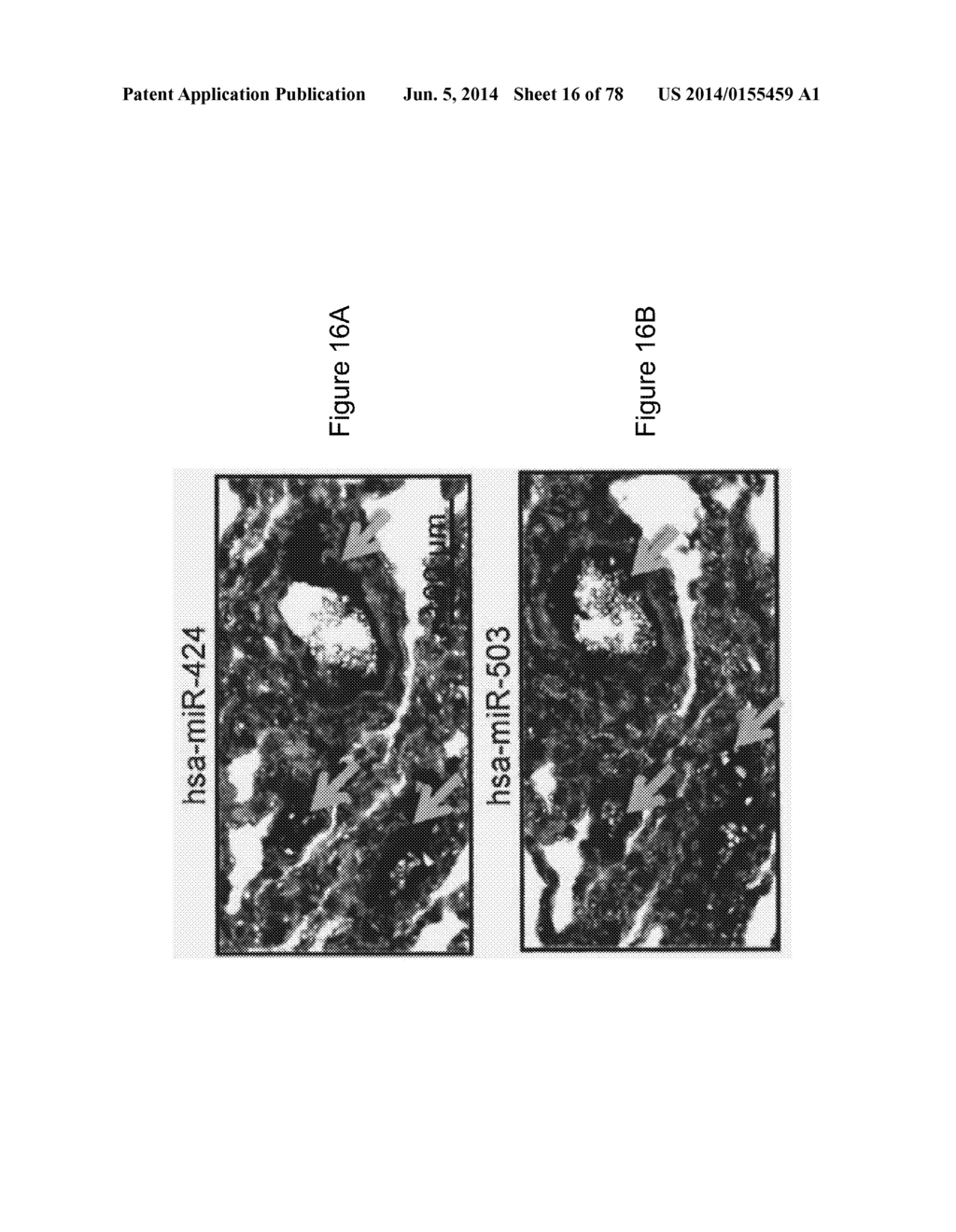 Compositions and Methods of Using Micro RNAs - diagram, schematic, and image 17