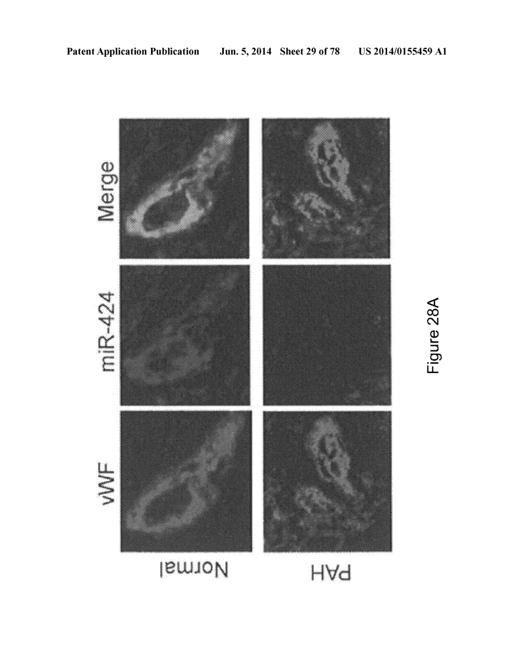 Compositions and Methods of Using Micro RNAs - diagram, schematic, and image 30